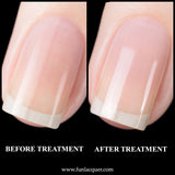 Premium Nail Treatment Nail Essential